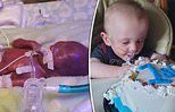 The world's most premature baby turns one-year-old after doctors gave him NO ...