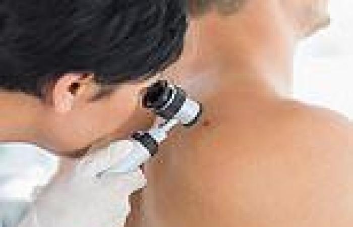 Skin cancer rate for men rises by HALF in ten years