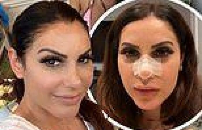 RHONJ star Jennifer Aydin shows off the results of plastic surgery after nose ...
