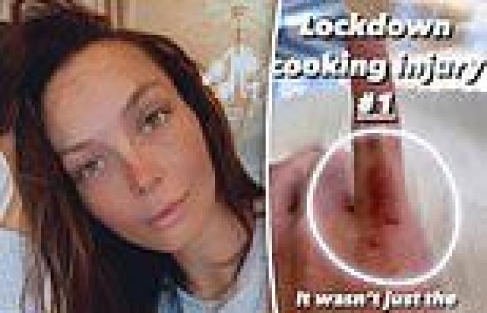 AGT: Ricki-Lee Coulter's misfortune continues as she injures herself in lockdown