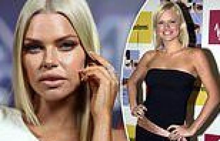 Love Island host Sophie Monk reveals her unexpected medical diagnosis