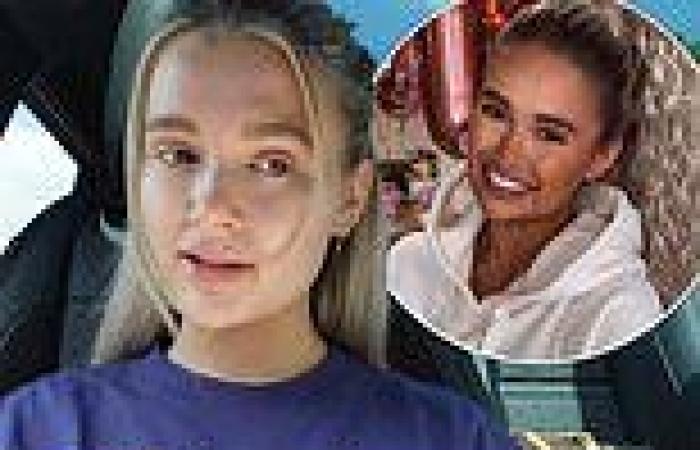 Molly-Mae Hague reveals she's had more of her fillers dissolved
