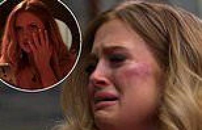 EastEnders fans are in shock as Tiffany Butcher-Baker's face swells up from ...