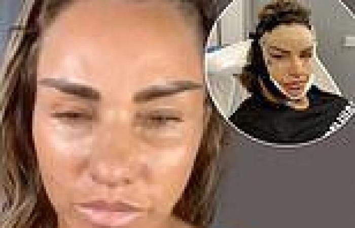 Katie Price goes makeup free to show off the results of her facelift in beauty ...