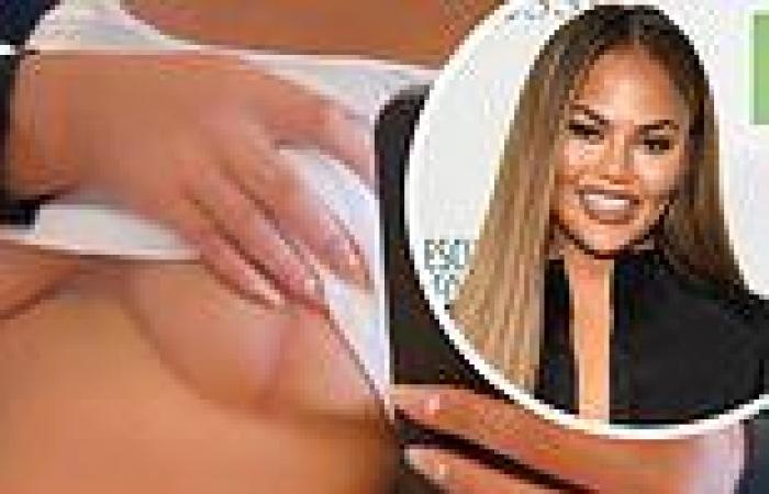 Chrissy Teigen flashes her breasts on Instagram revealing scars from having ...