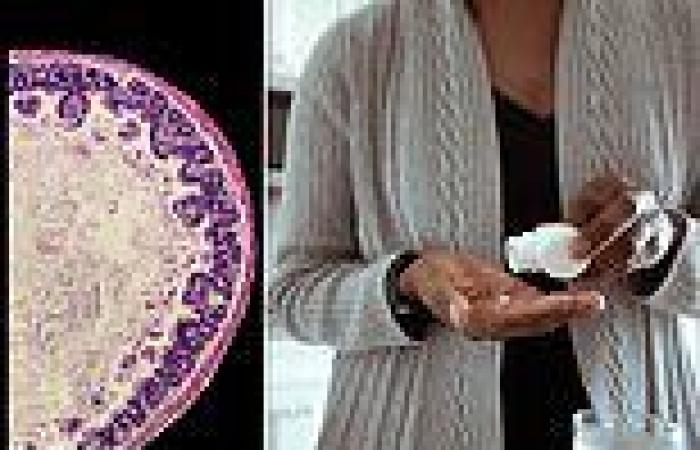 Gut disorder common in low-income countries could impair immune response, mouse ...