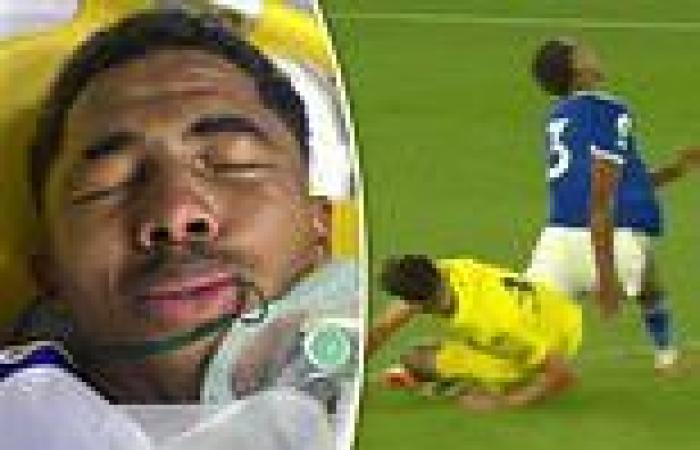 sport news Leicester's Wesley Fofana is taken off with a suspected BROKEN LEG after ...