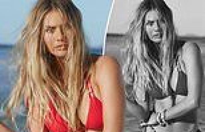 Elyse Knowles calls for more discussion about mental health as she poses in ...