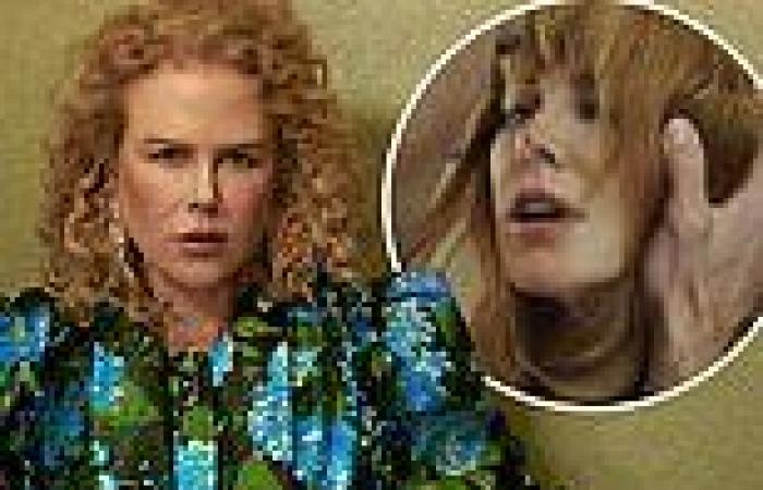 Nicole Kidman reveals she had to explain her character's bruises in Big Little ...