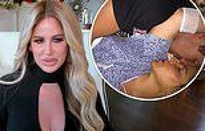 Kim Zolciak still has issues stemming from 2015 stroke: 'At times I can't find ...