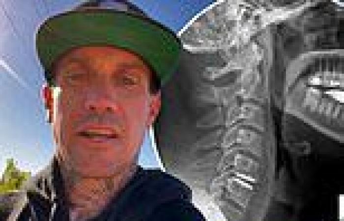 Pink's husband Carey Hart posts X-rays after successful neck surgery to replace ...