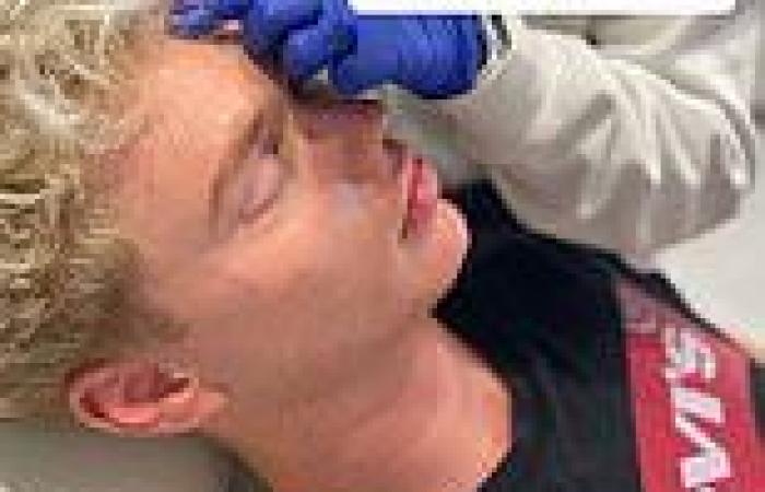 Australia's Got Talent star Jack Vidgen get Botox after lockdown