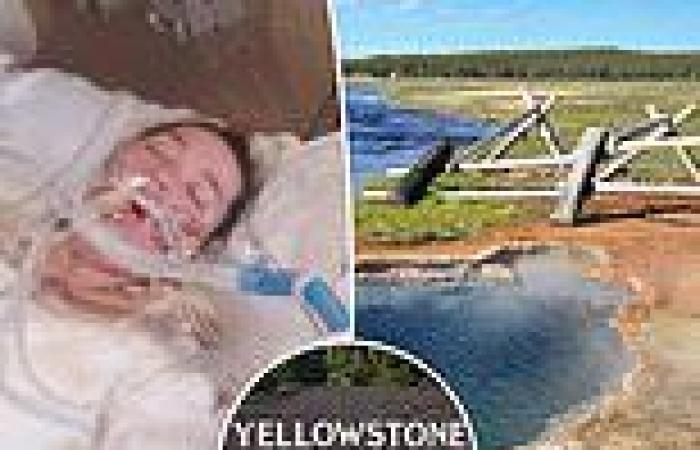 Woman, who badly burned herself after jumping in a geyser at Yellowstone, ...