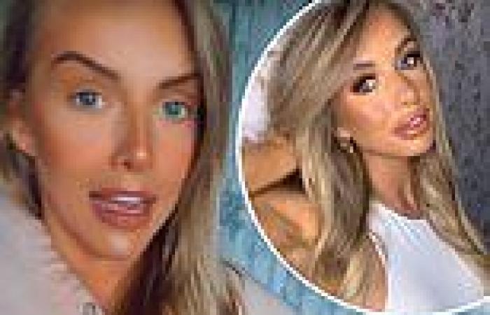 Love Island's Faye Winter shows off her natural lips after getting her fillers ...