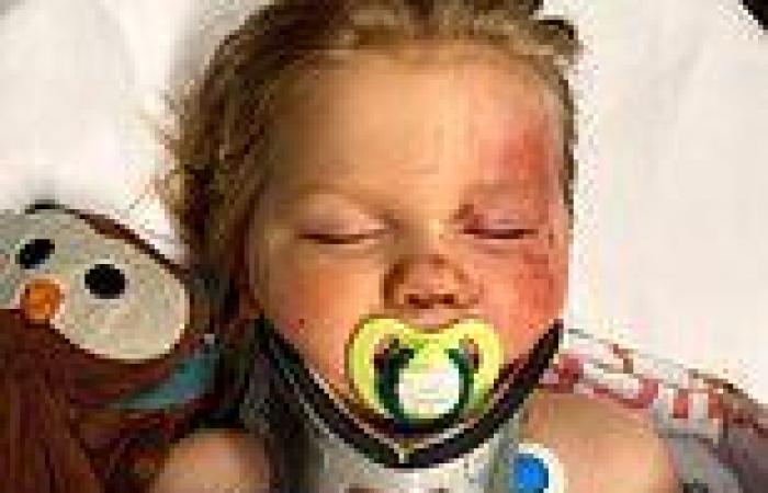 Montrose two-year-old survives crash as bicycle shields head from becoming ...