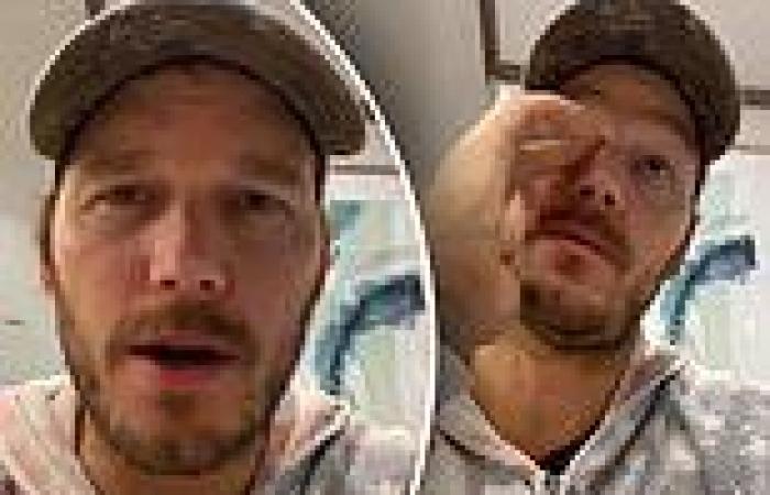 Chris Pratt admits being 'upset' and 'depressed' after backlash for ...