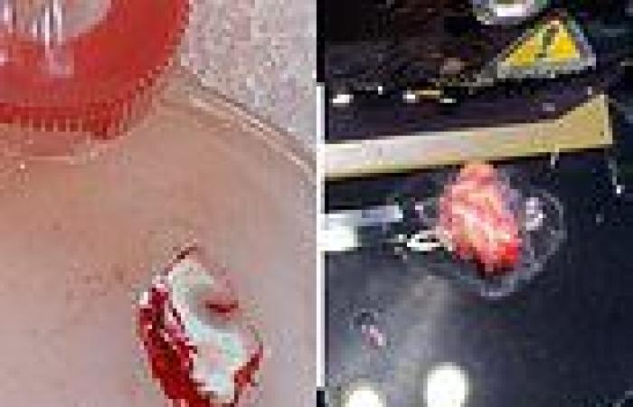 Slice of human BRAIN is kept alive in a petri dish for 12 hours for the first ...