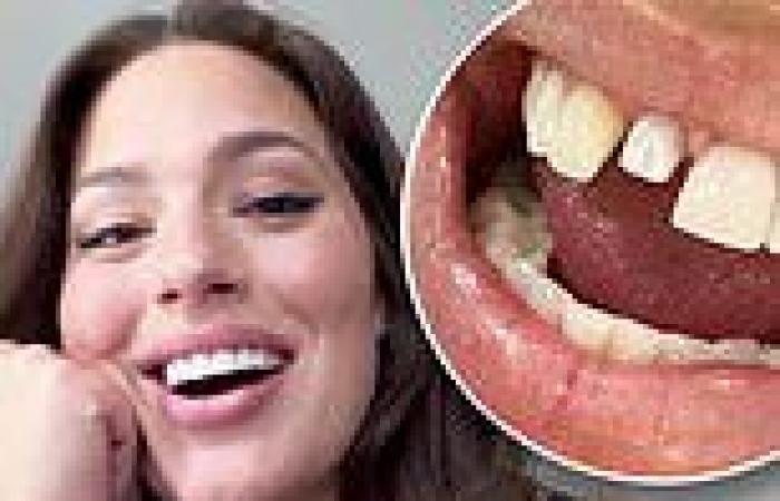 Ashley Graham gets her front tooth knocked out by son Isaac after he 'head ...