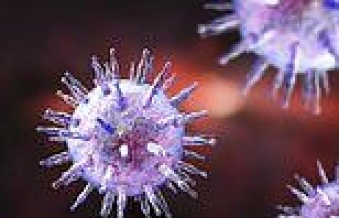 Glandular fever may be the biggest cause of multiple sclerosis