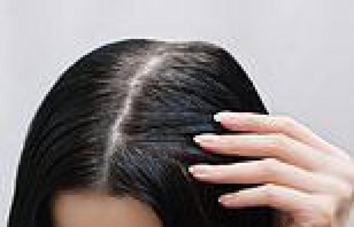 What's the best remedy for a flaky, itchy scalp? DR MARTIN SCURR answers your ...