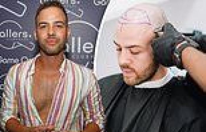 MAFS NZ: Samuel Levi undergoes a 'life changing' hair transplant