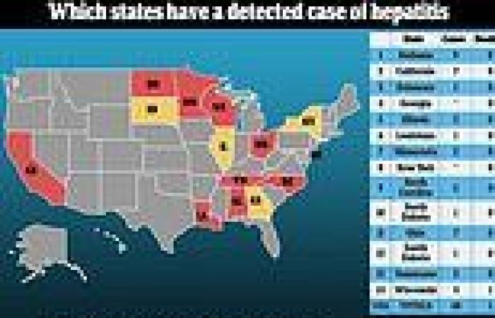 Five children have died from hepatitis in the US and 109 cases have been ...
