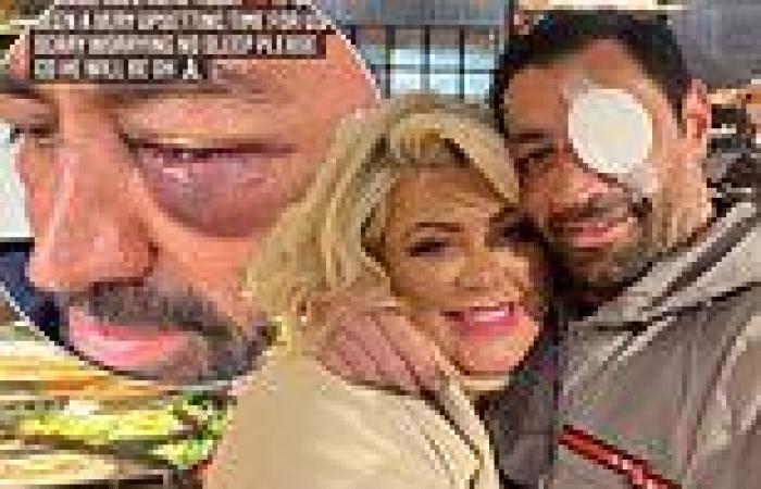 Sunday 8 May 2022 01:23 AM Gemma Collins reveals that fiancé Rami Hawash's eye may not gain full sight ... trends now