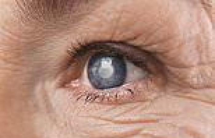 Monday 16 May 2022 11:13 PM The end of cataract surgery? Experts say vision-robbing condition may soon be ... trends now