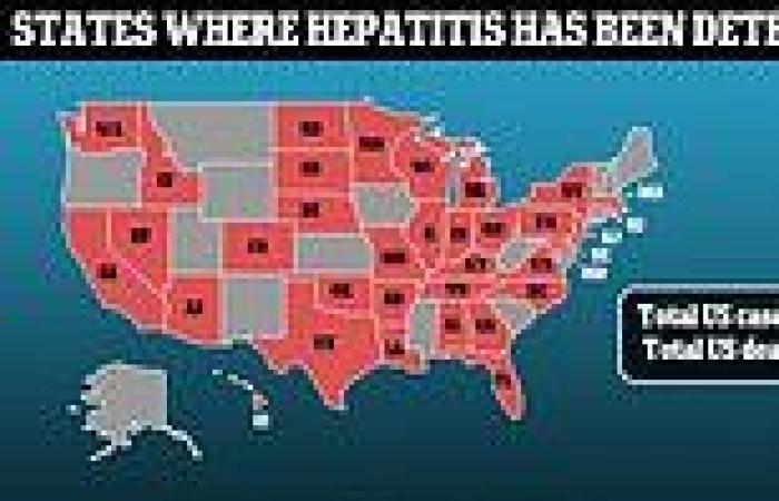 Friday 20 May 2022 08:04 PM Another child has died in the US mysterious hepatitis outbreak trends now