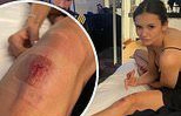 Tuesday 7 June 2022 12:07 AM Nina Dobrev reveals her bloody injury on her yacht party for the F1 Monaco ... trends now