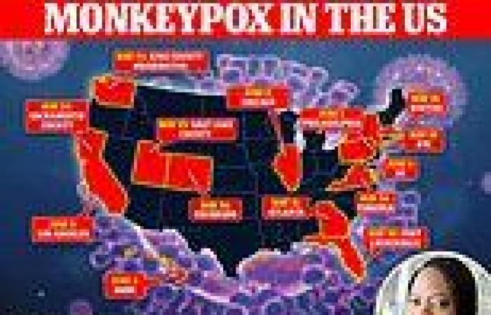 Tuesday 7 June 2022 05:58 PM The US already has up to 300 monkeypox cases - nine times official tally of 31, ... trends now