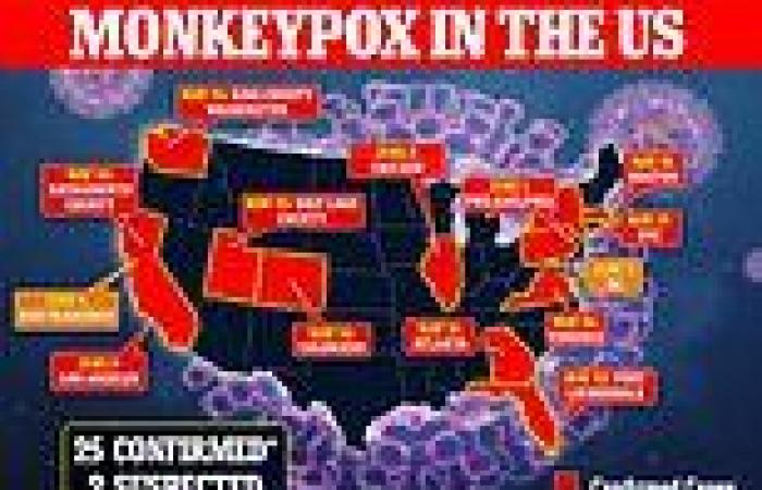 Tuesday 7 June 2022 12:34 AM CDC confirms there are now 31 cases of monkeypox across the United States trends now
