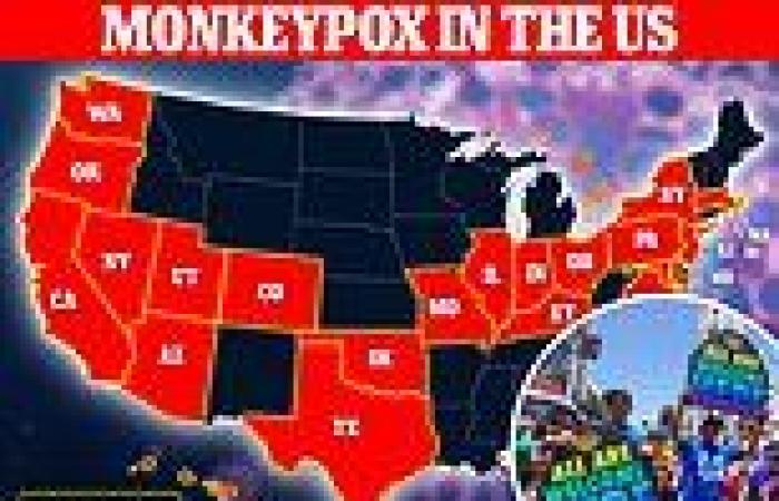 Monday 27 June 2022 05:03 AM Los Angeles health officials warn of monkeypox outbreak spreading among gay men ... trends now