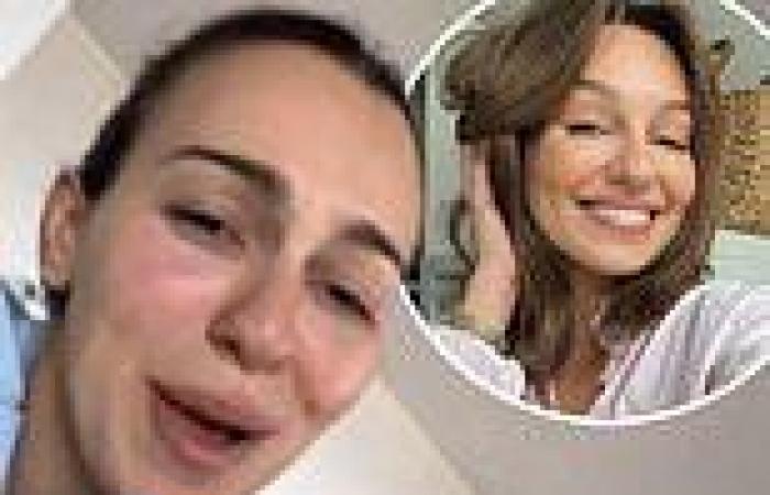 Tuesday 9 August 2022 07:52 AM Bachelor star Bella Varelis admits to getting fillers under her eyes and in her ... trends now