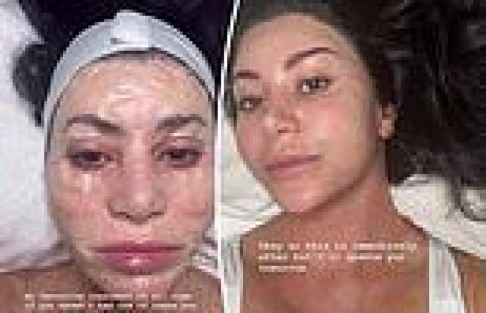 Friday 30 September 2022 03:08 AM MAFS star Martha Kalifatidis gets a top shelf facial and looks terrifying trends now
