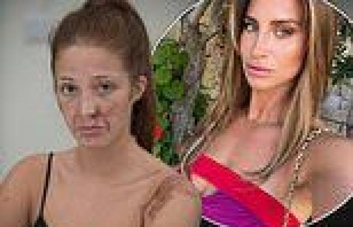 Sunday 20 November 2022 08:29 PM Ferne McCann blasted over 'insincere' apology by acid attack victim Sophie Hall trends now