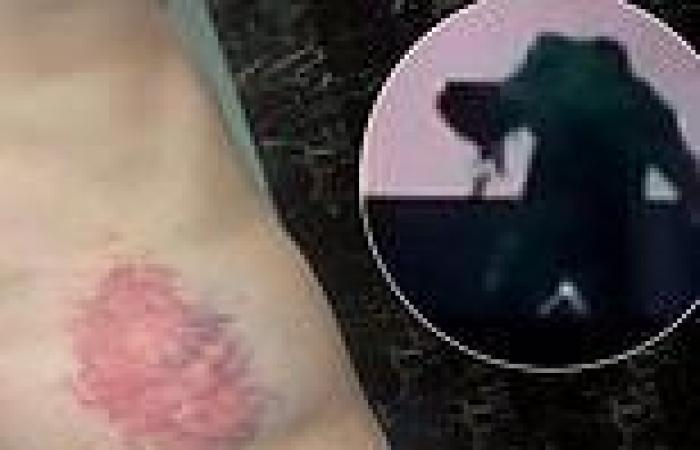 Sunday 20 November 2022 07:44 PM Westlife's Nicky Byrne shares snaps of his injuries after FALLING through stage ... trends now