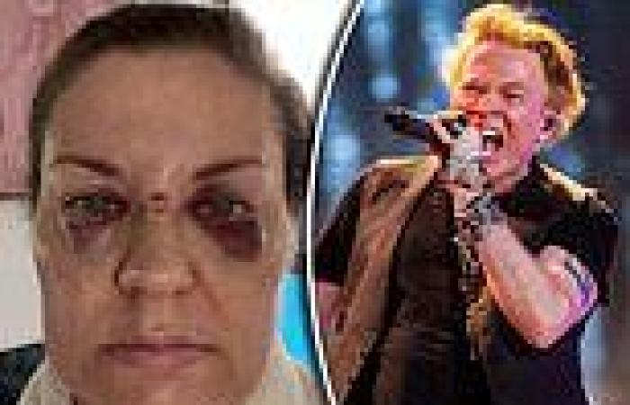 Concertgoer left 'injured' at Guns N' Roses'  concert after frontman Axl ... trends now
