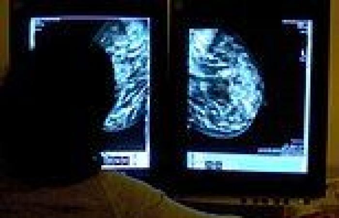 Women should get ANNUAL breast cancer scans, claims Government's women's health ... trends now