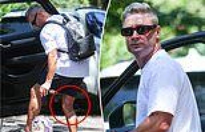 Pup's shock injury: Michael Clarke seen with huge bruise after brawl trends now