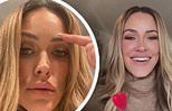 Peta Murgatroyd reveals hormonal acne with candid photo and then posts a ... trends now