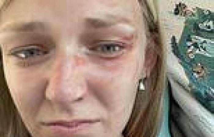 Gabby Petito selfie shows her with bruised face moments before traffic stop ... trends now