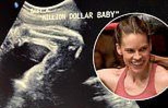 Pregnant Hilary Swank shares ultrasound of her 'million dollar baby' flexing ... trends now