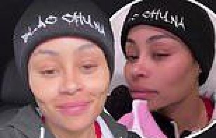'Don't even do it': Blac Chyna issues warning to young women over 'crazy' ... trends now