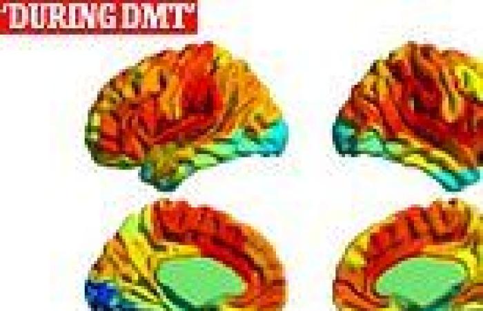 This is what your brain looks like on DMT - the powerful chemical in ayahuasca ... trends now