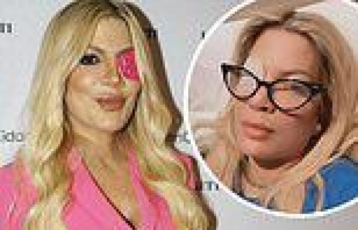Tori Spelling reveals reason for bedazzled eye patch as she thanks fans for ... trends now