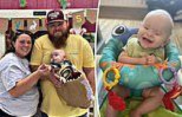 Baby, 1, born without eyes undergoes 'socket stretching' so he can have ... trends now