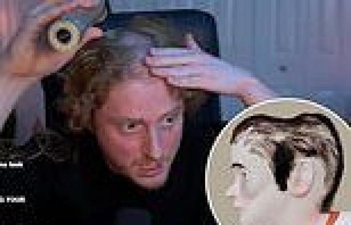 Do YOU have 'gamer head'? Twitch user finds indent on his cranium from wearing ... trends now