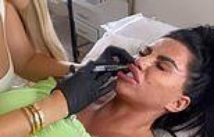 Katie Price is left wincing in pain as she gets her lip filler dissolved before ... trends now