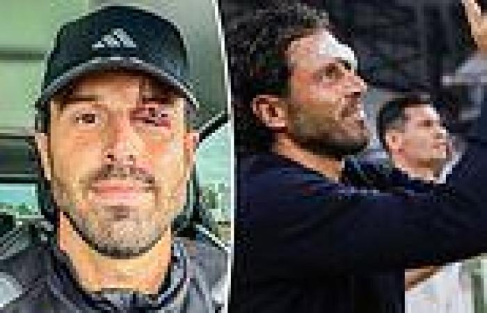 sport news Lyon head coach Fabio Grosso breaks his silence after needing 13 STITCHES in ... trends now